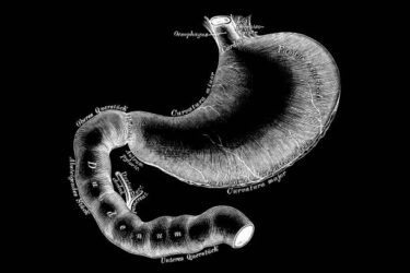 胃潰瘍・十二指腸潰瘍