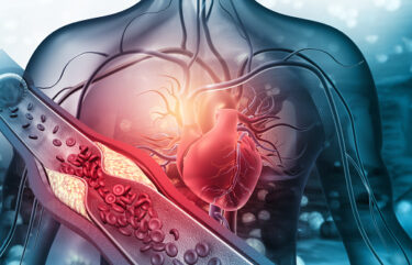 心臓弁膜症②　心臓弁膜症の種類